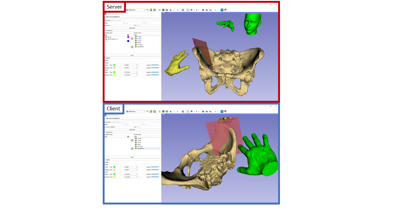 SlicerCollaboration screenshot server/client